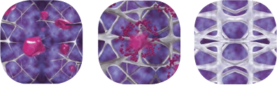 How Sculptra Works