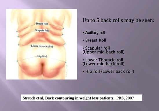 Back Enhancement