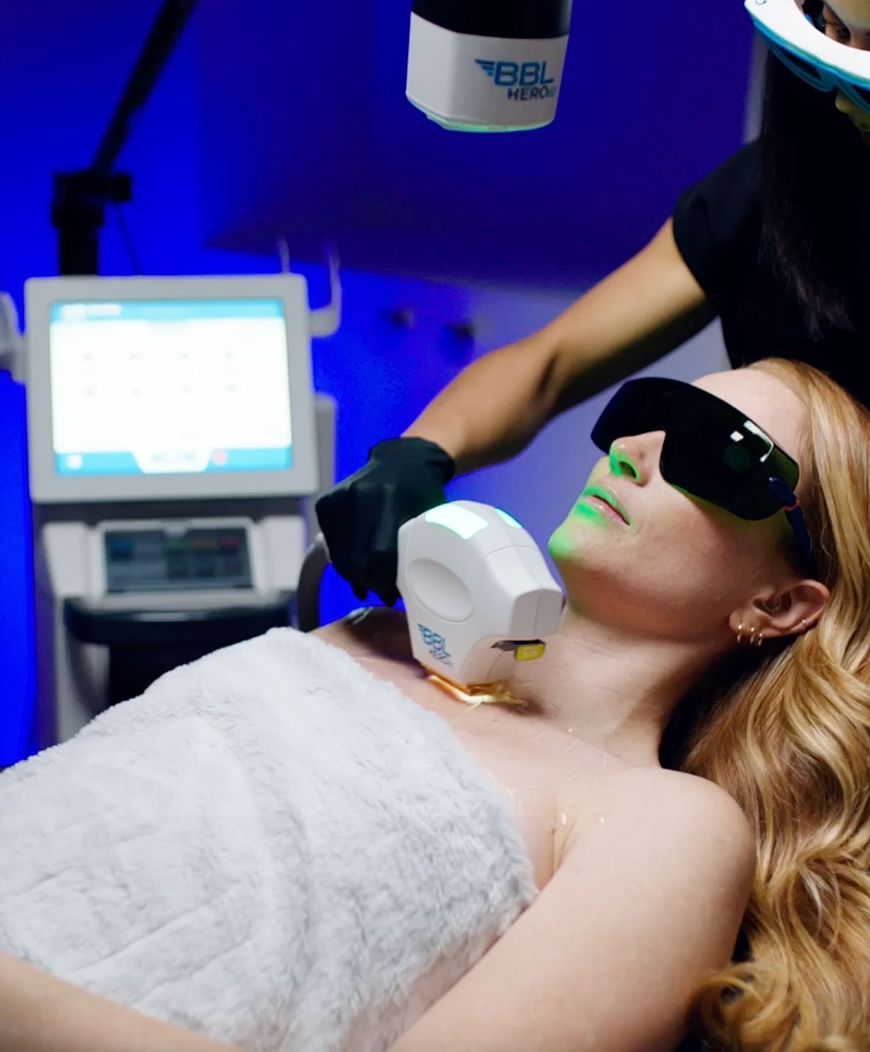 BBL laser treatment session on a client.