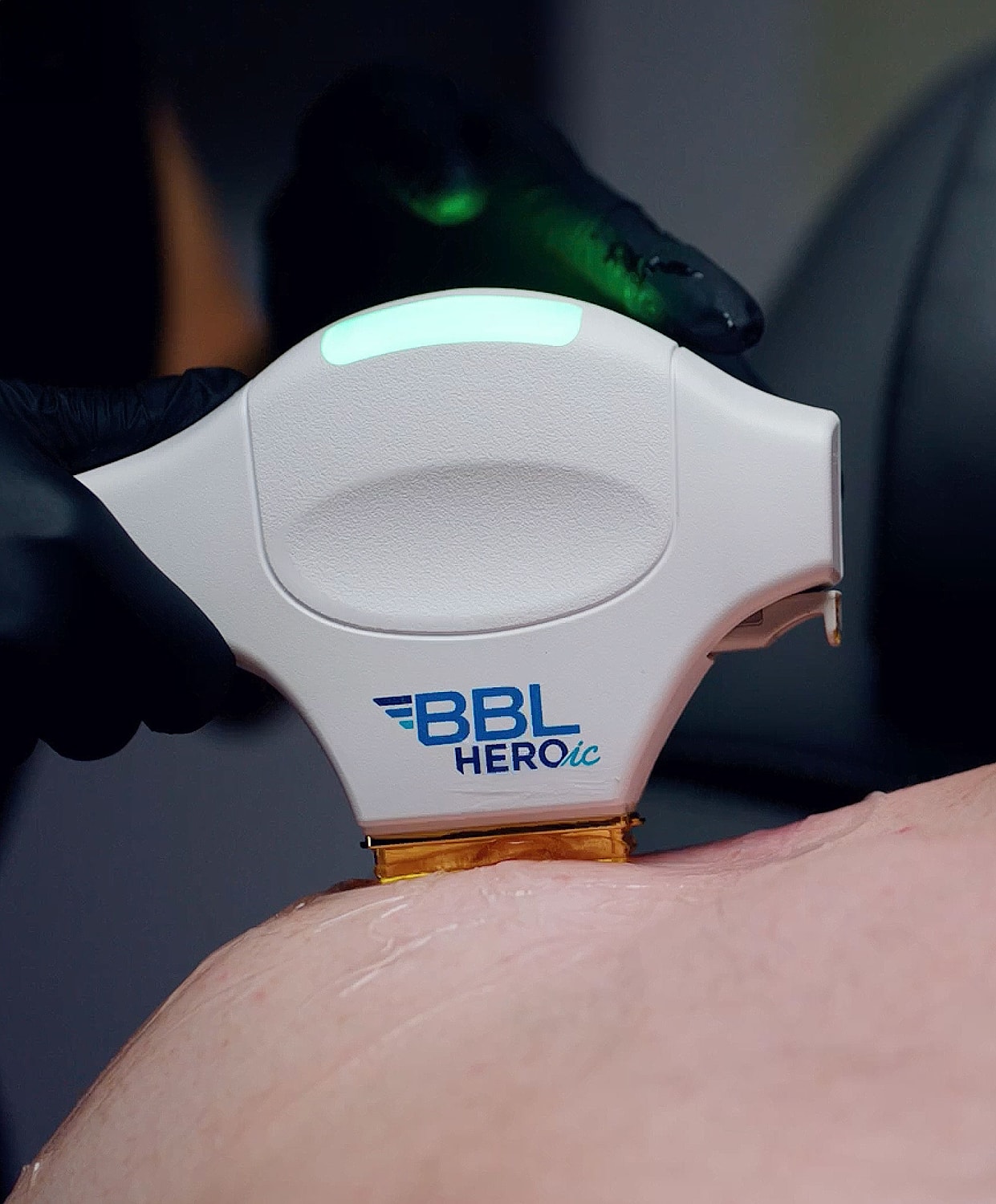 BBL device being used on skin treatment.
