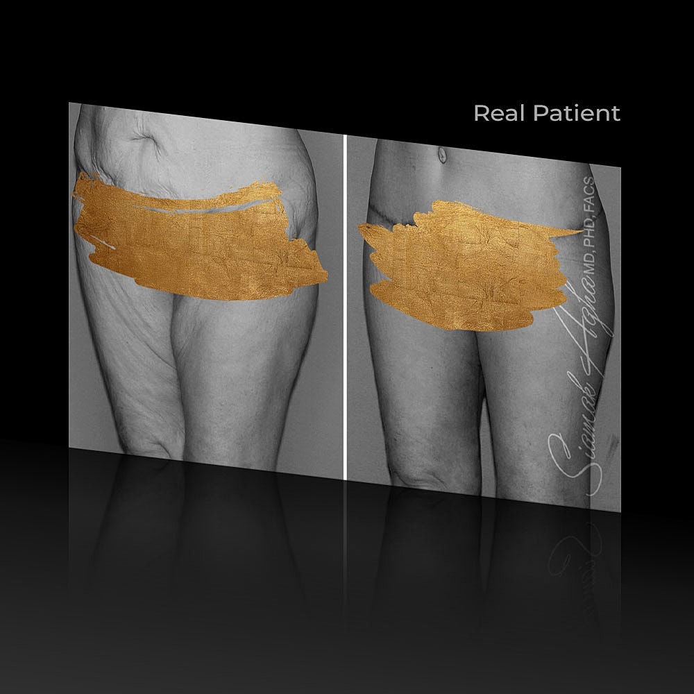 Surgeon performing a procedure in operating room.