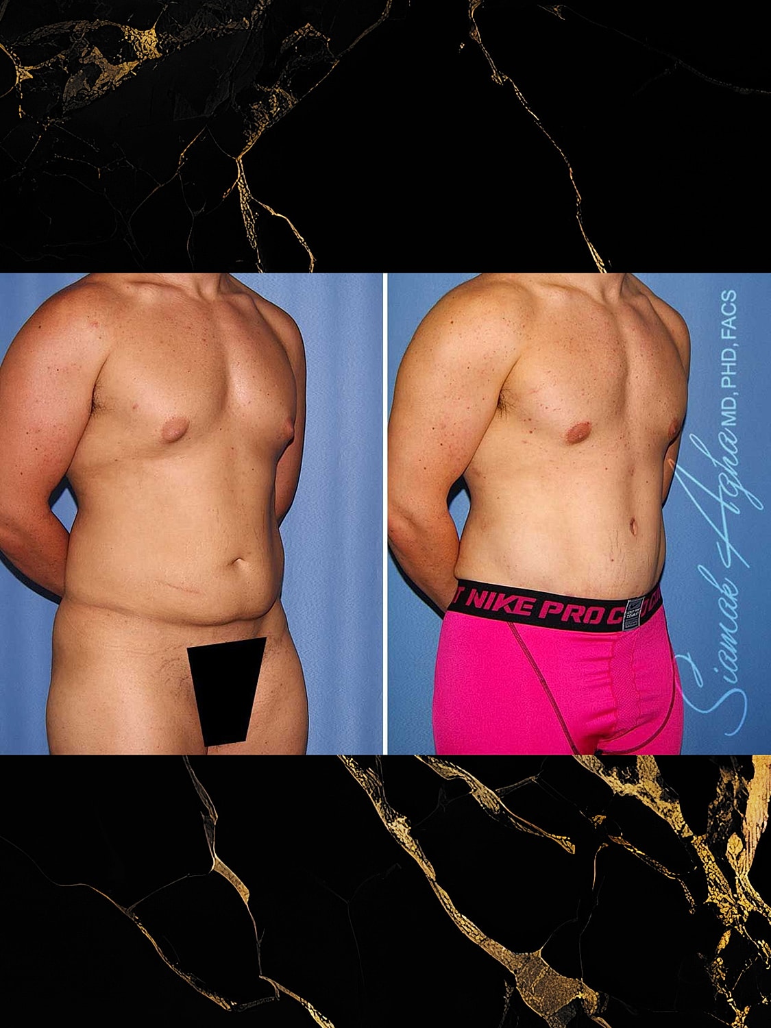 Before and after male body transformation images.