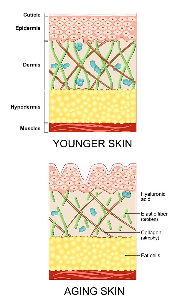 Comparison of younger and aging skin layers.