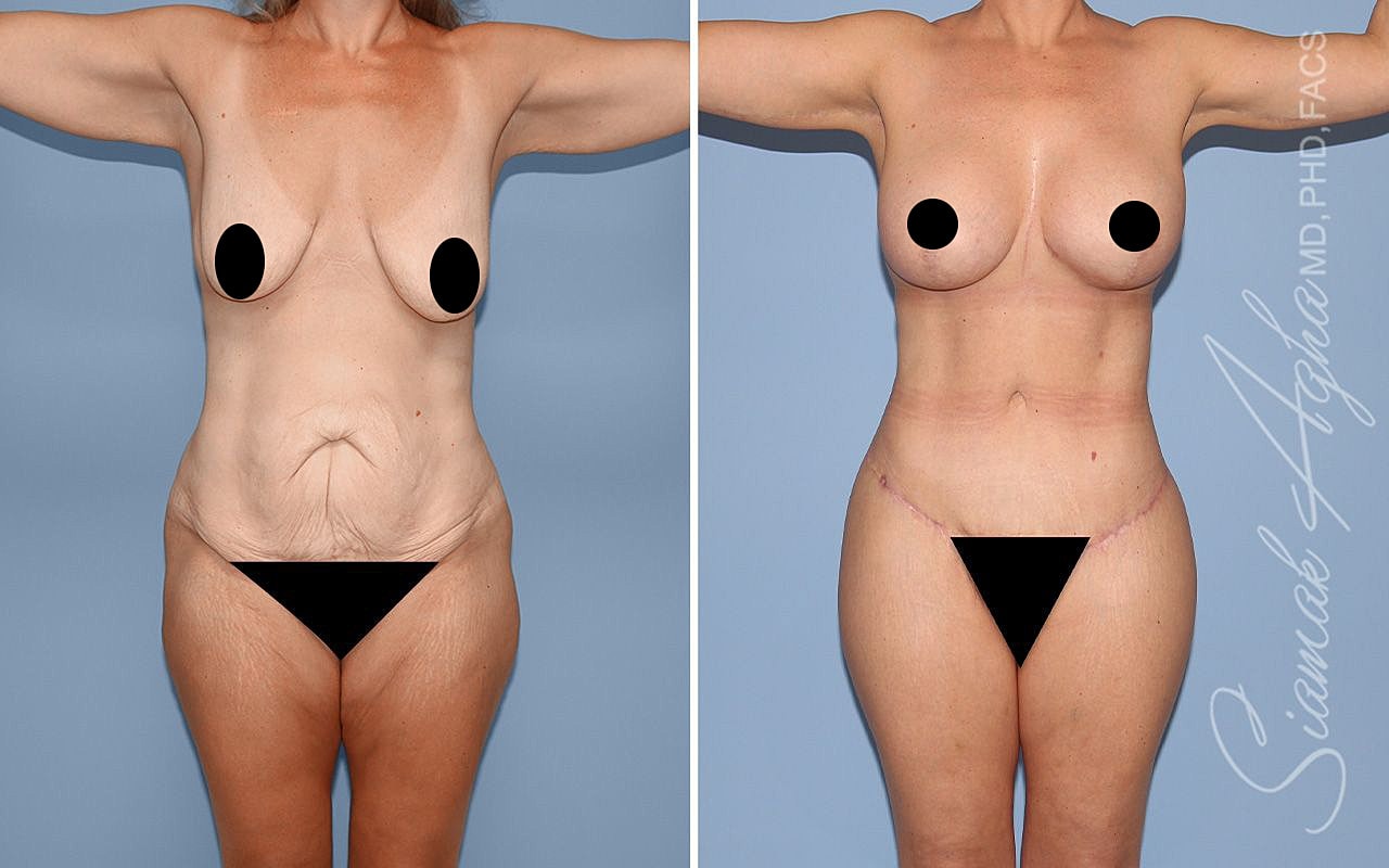 Before and after body transformation image.