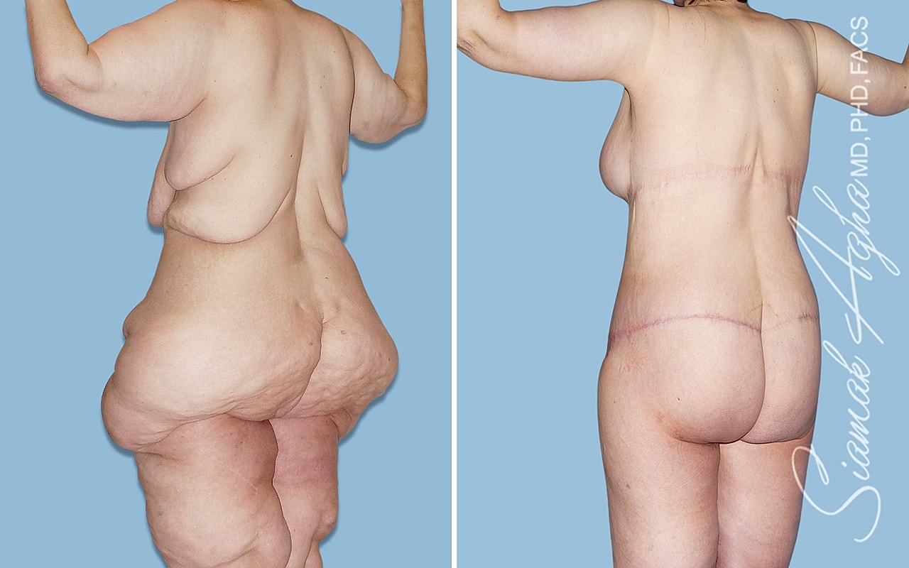 Before and after body transformation photos