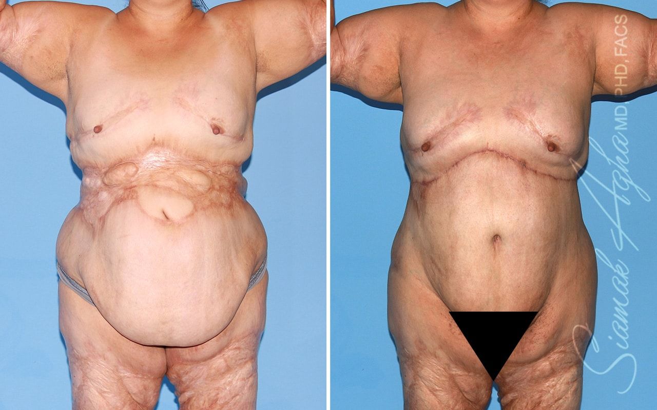 Reconstructive Gallery Before & After