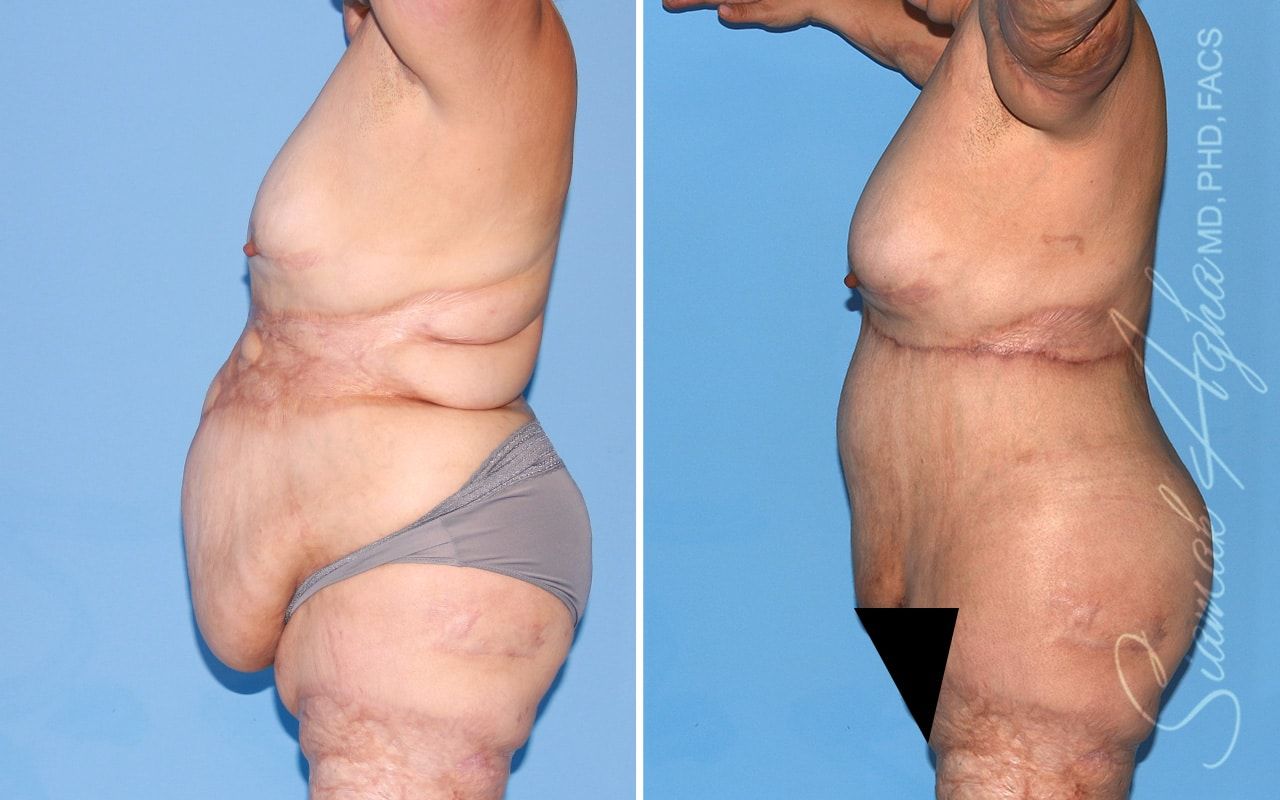 Reconstructive Gallery Before & After