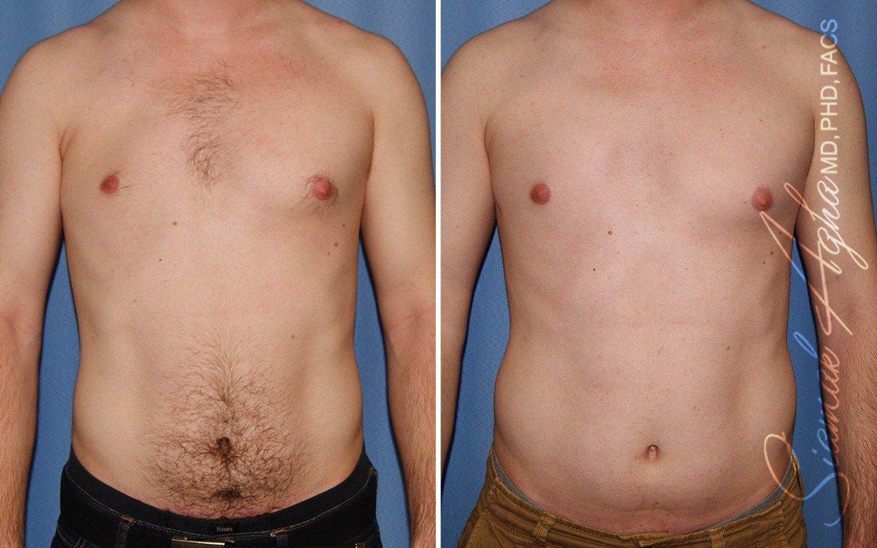 Reconstructive Gallery Before & After