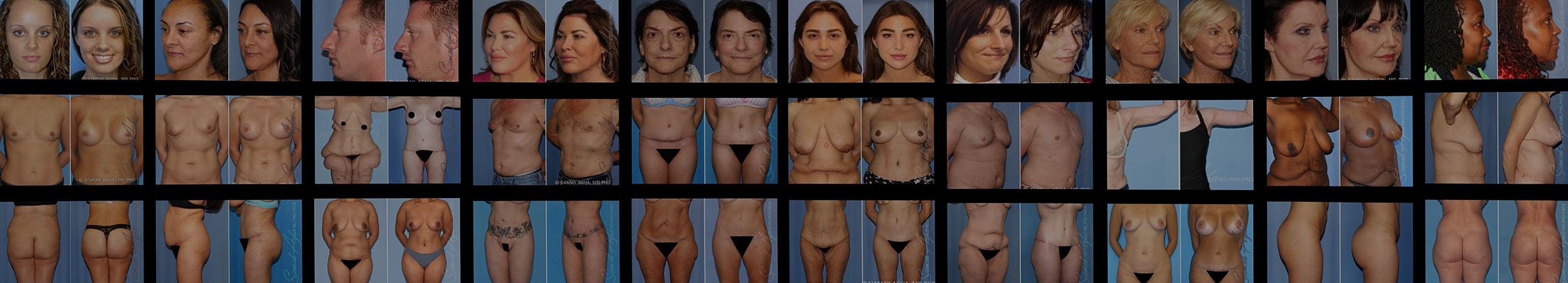 Diverse gallery of body types and shapes.