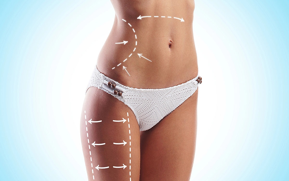 Woman in bikini with curves highlighted by arrows.