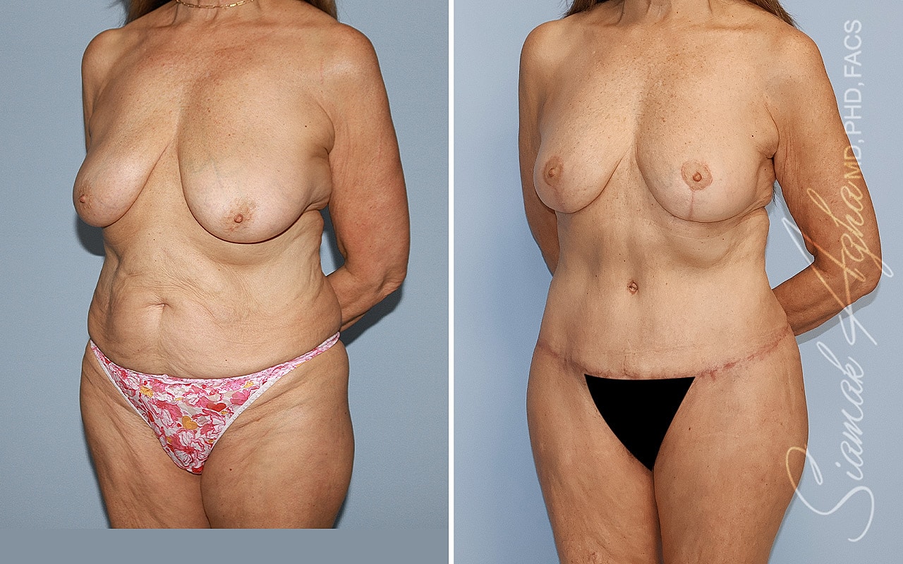 Before and after body transformation images.
