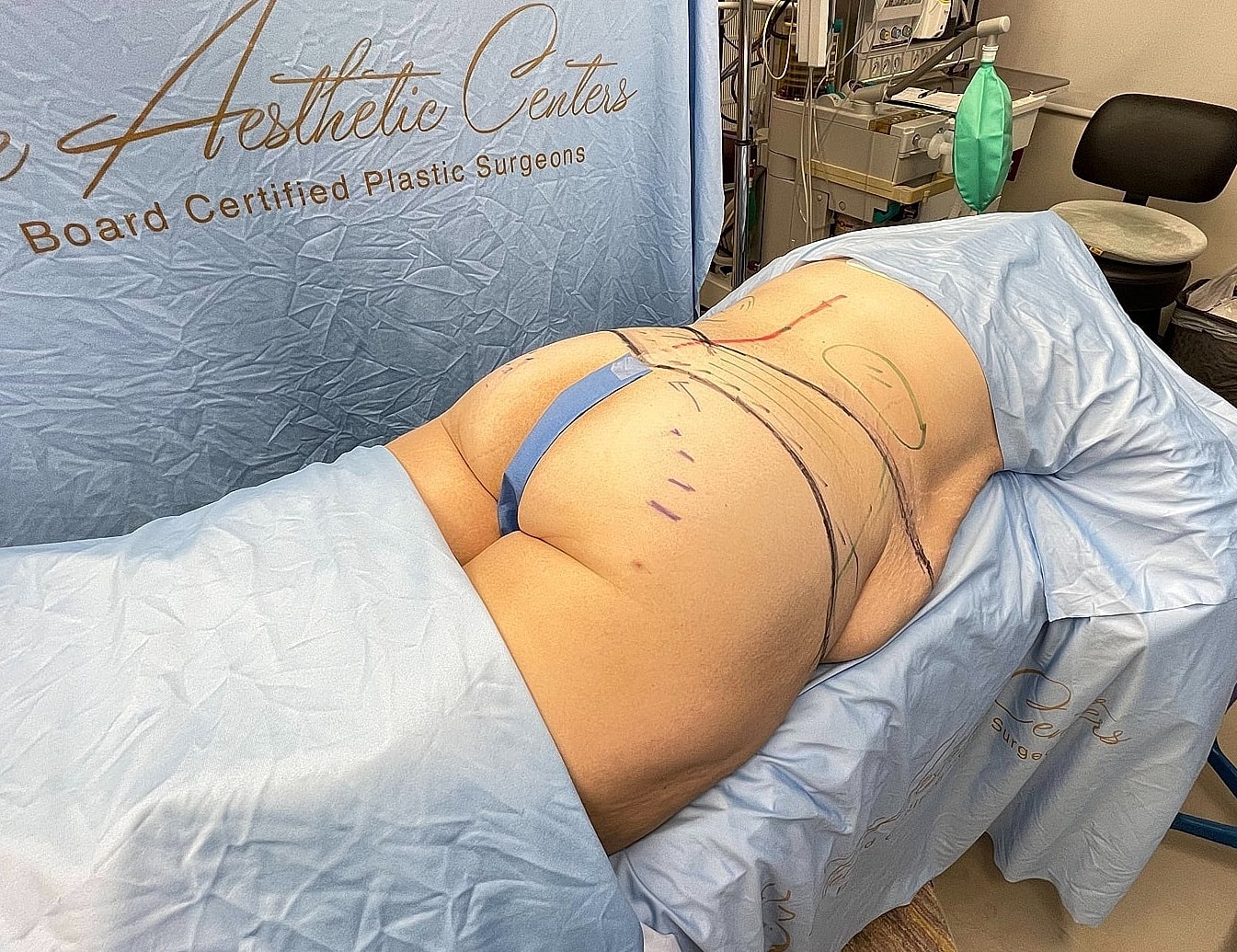 Patient preparation for surgical procedure in clinic.