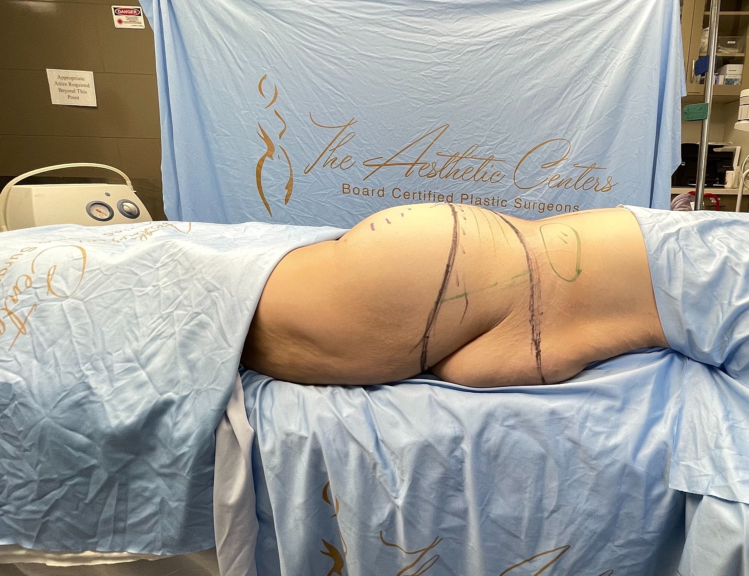 Surgical preparation on patient at aesthetic center.