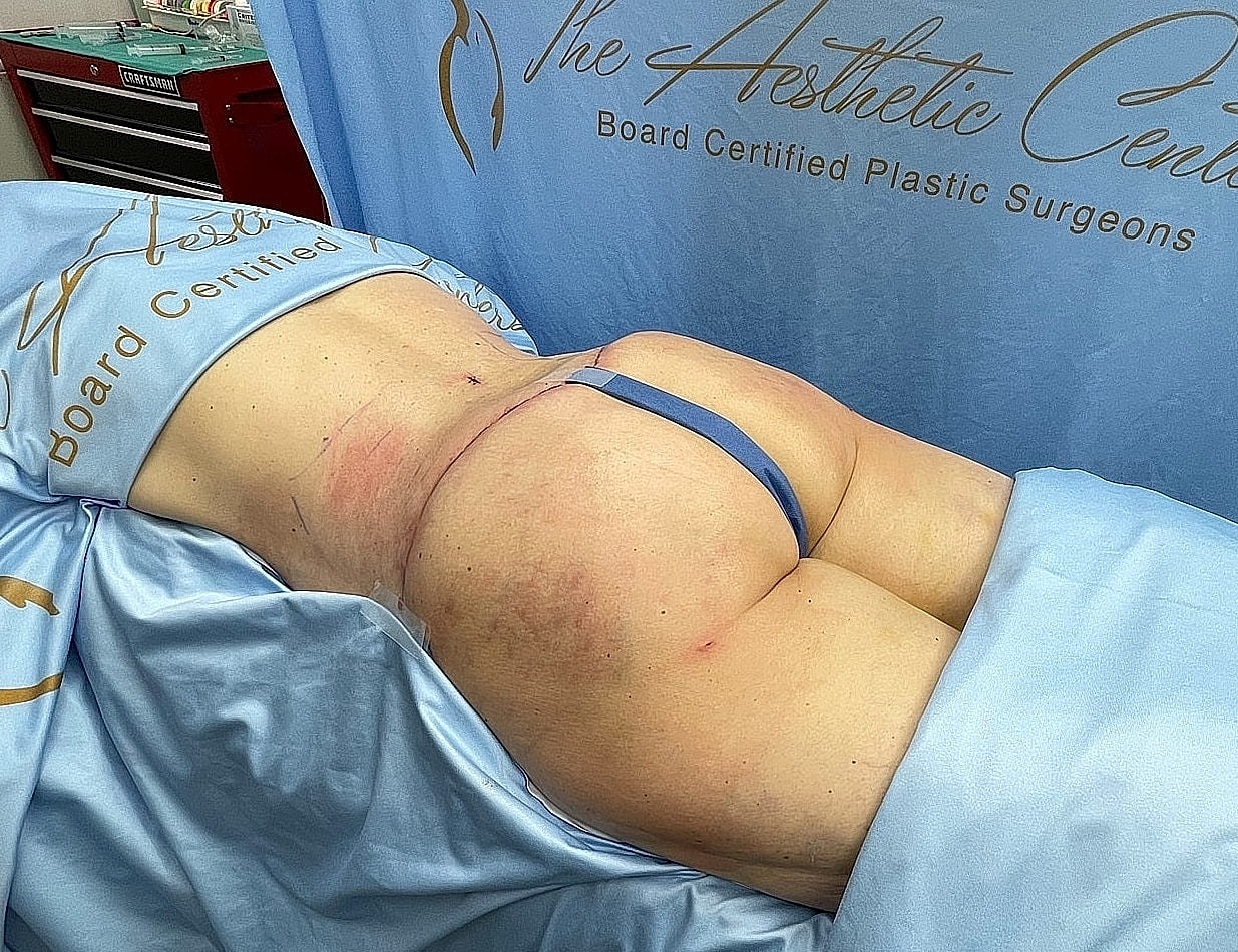 Surgical setting with patient on operating table.