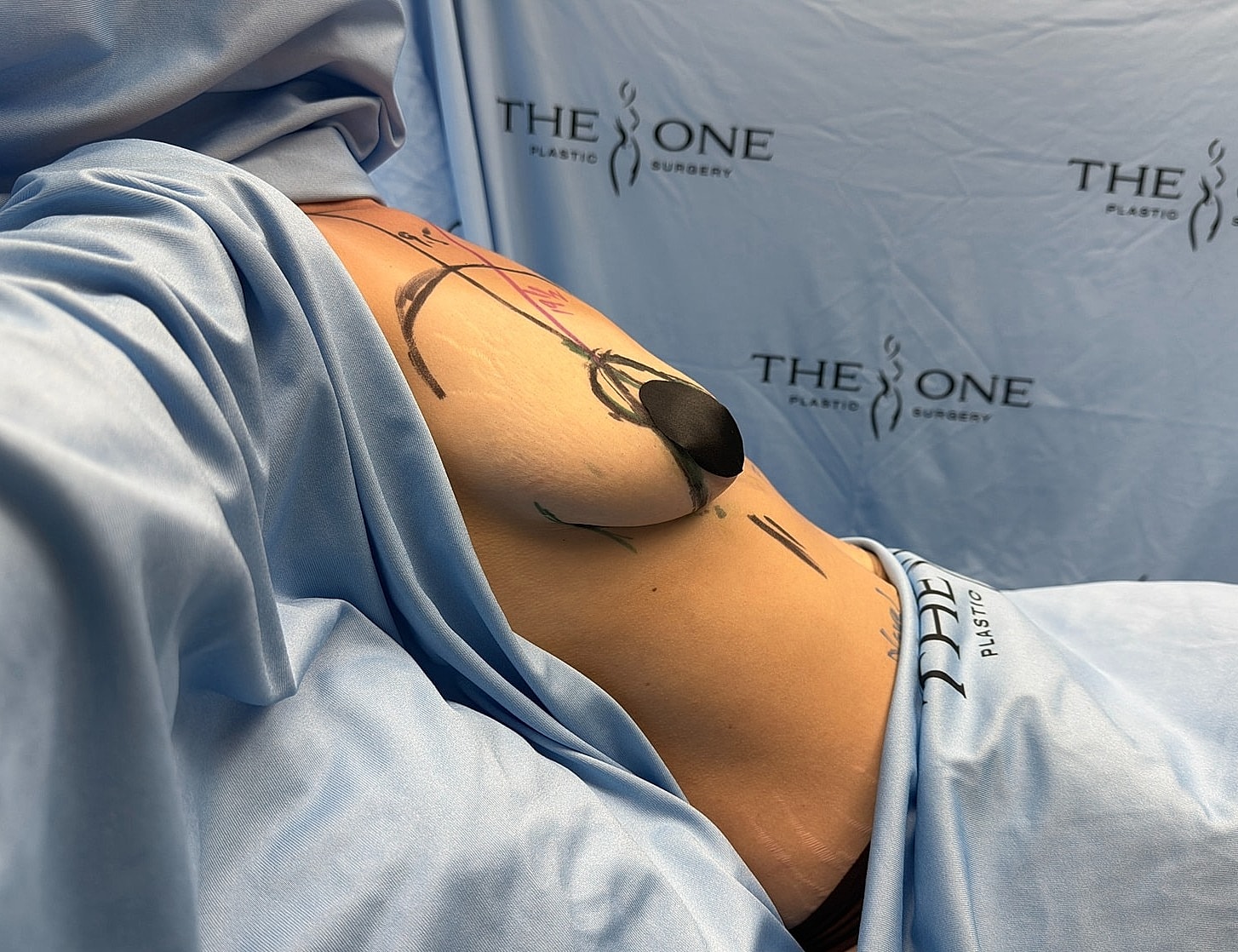 Body contouring procedures in a clinical setting.