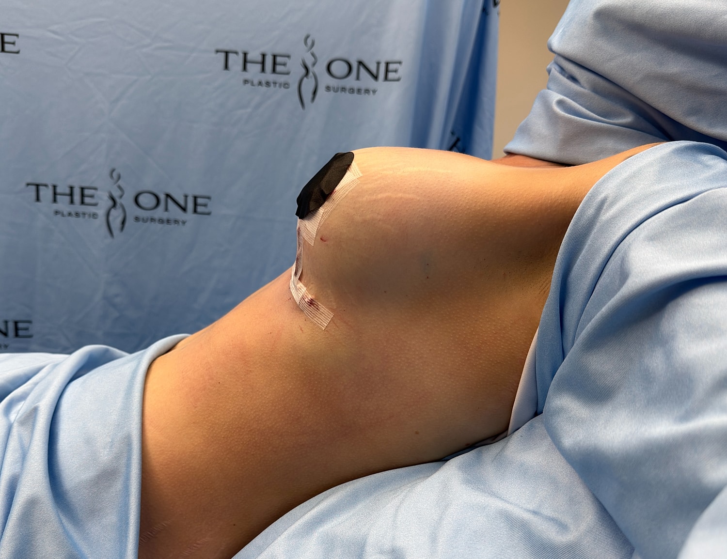 Post-surgical patient in blue gown, bandaged area.