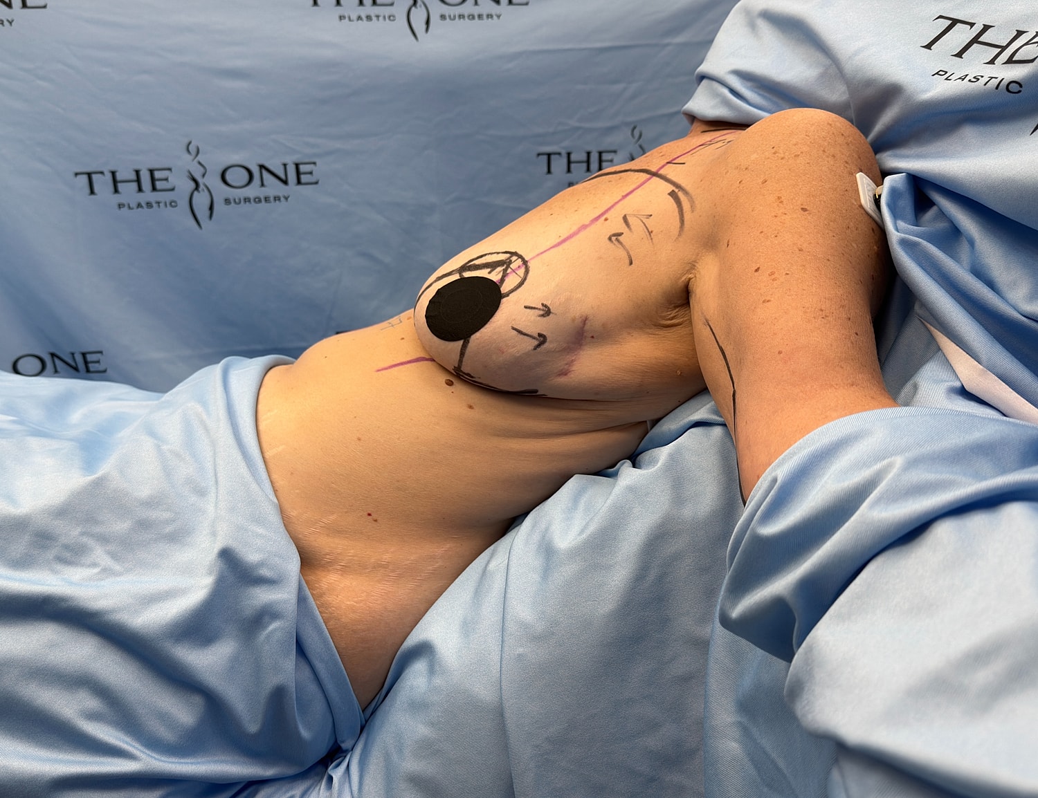 Patient preparation for surgical procedure at clinic.