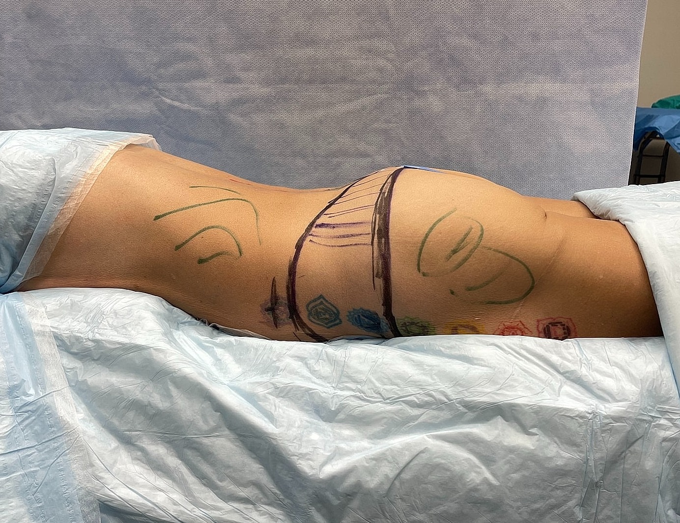 Side view of torso with markings and draping.