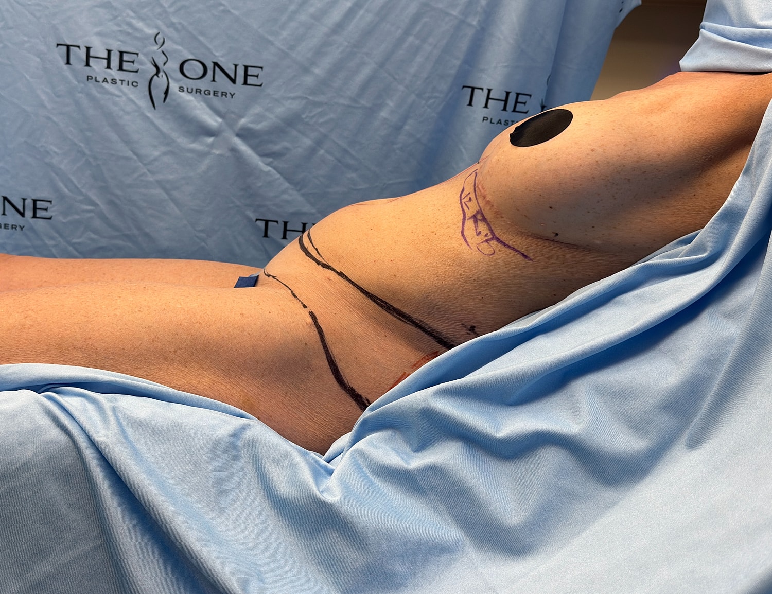 Pre-surgery patient positioning in surgical environment.