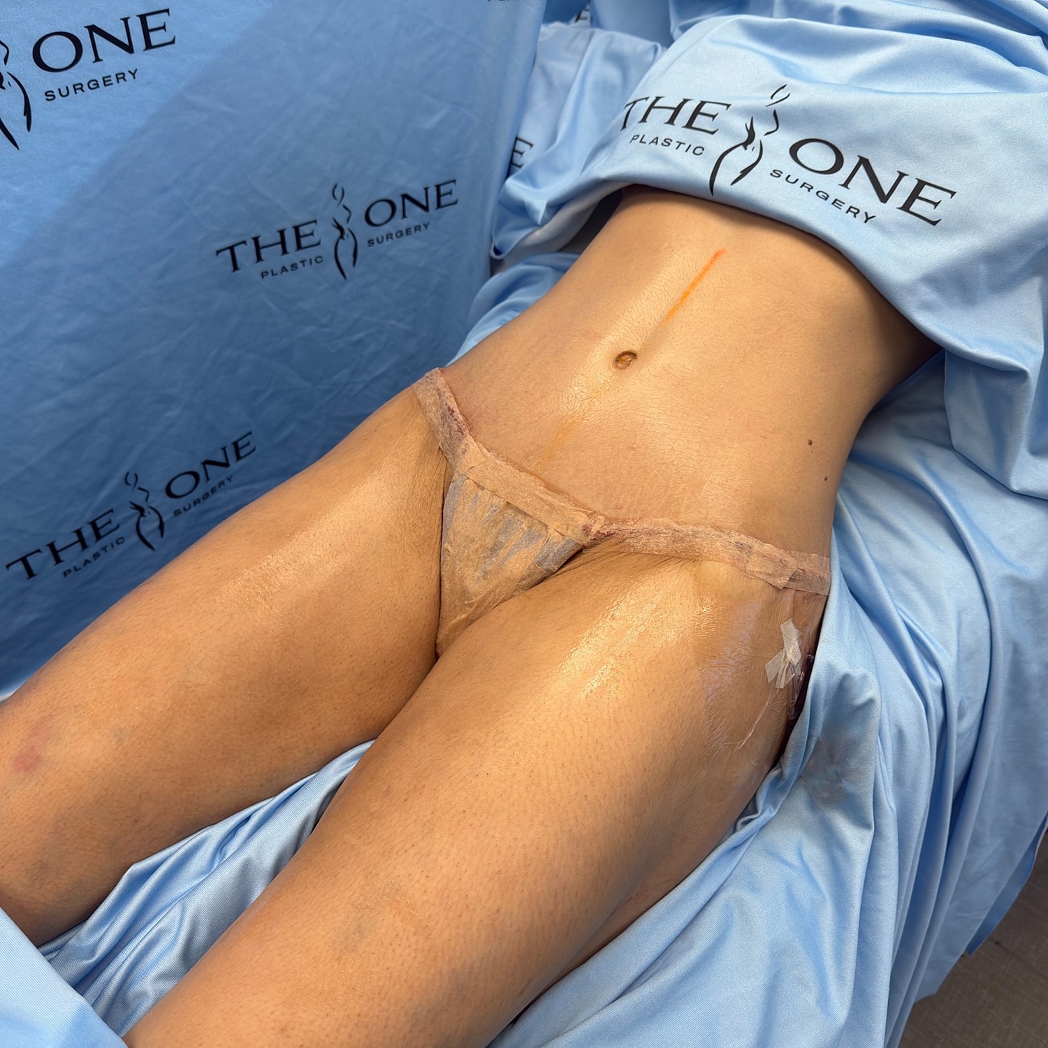 Post-surgery patient in a medical setting.