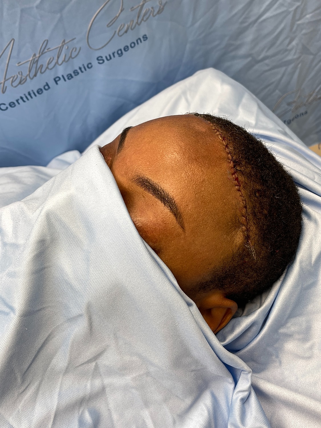 Patient recovering with surgical bandage on head.
