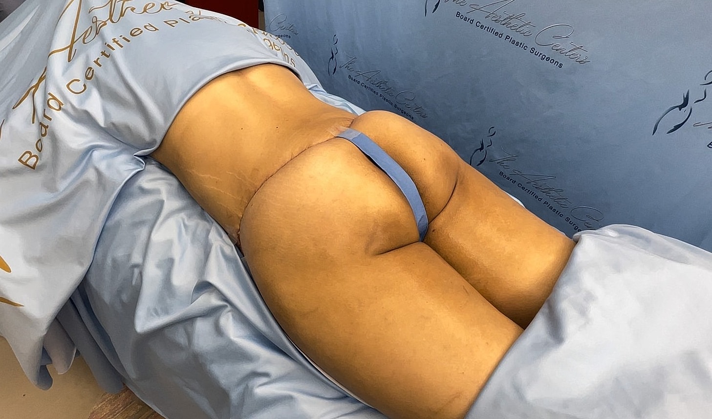 Patient preparing for cosmetic surgery procedure.