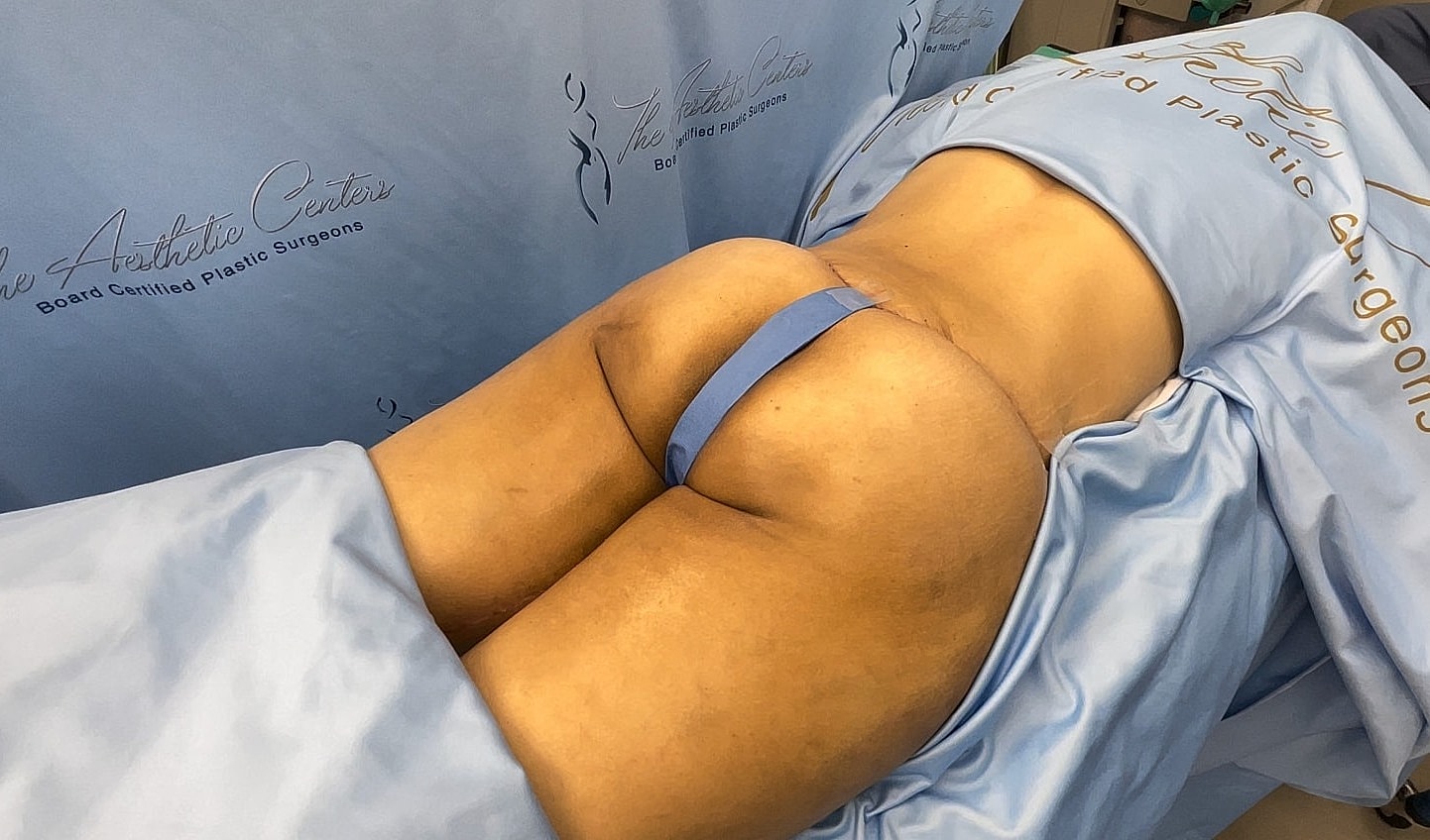 Patient preparing for cosmetic procedure in clinic.